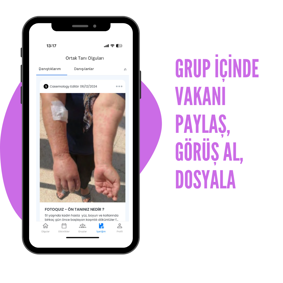 Grup içinde vakanı paylaş - Casemology platformunda vaka paylaşımı