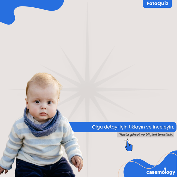 ATEŞ, DÖKÜNTÜ VE KASILMA olgusu - Pratisyen Hekim kategorisi