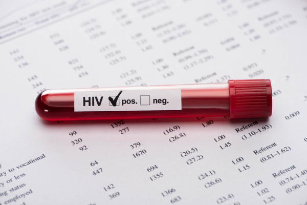 HIV EĞİTİM MODÜLÜ 1.1 olgusu - Tıp Fakültesi Öğrencisi  4. Sınıf kategorisi