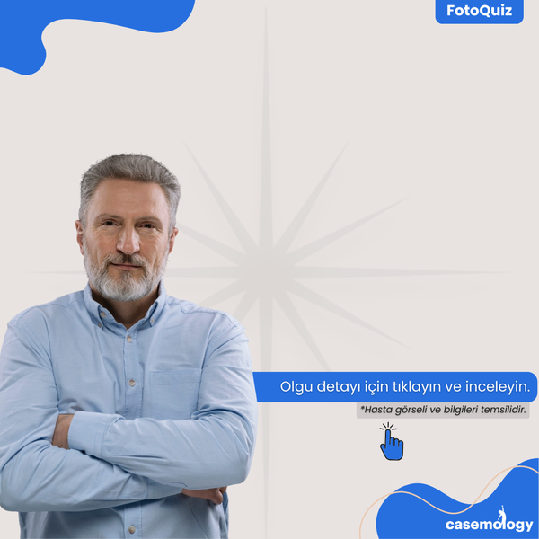 SAĞ AYAKTA LEZYONLAR olgusu - Pratisyen Hekim kategorisi