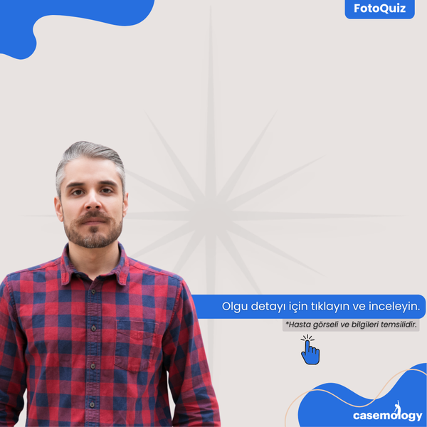 SES KISIKLIĞI olgusu - Pratisyen Hekim kategorisi