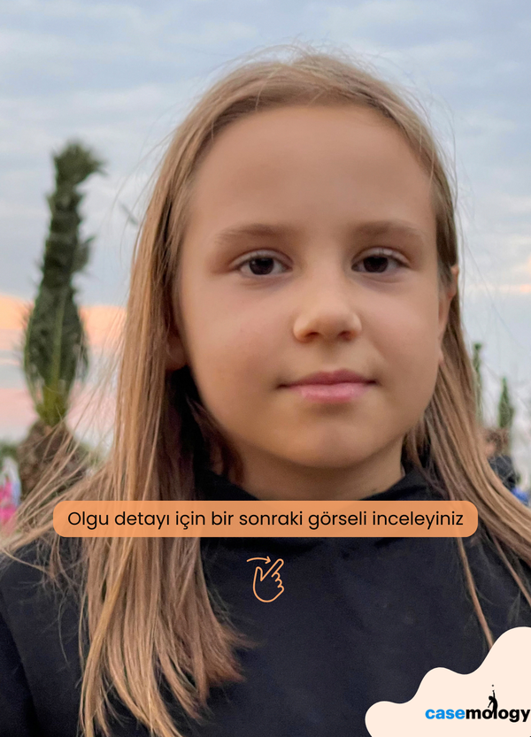 YÜKSEK ATEŞ VE DÖKÜNTÜ olgusu - Tıp Fakültesi Öğrencisi  4. Sınıf kategorisi