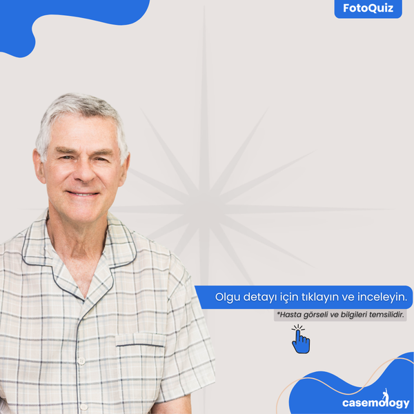 HİS KAYBI VE KONUŞMADA ZORLANMA olgusu - Pratisyen Hekim kategorisi