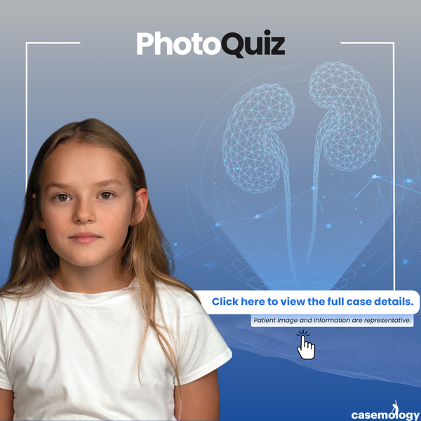 9-YEAR-OLD FEMALE PATIENT olgusu - Çocuk Ürolojisi kategorisi