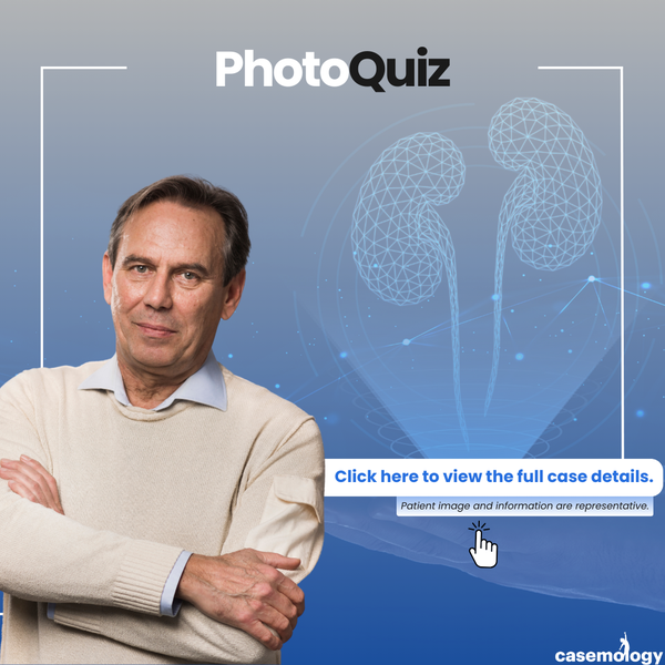 58-YEAR-OLD MALE PATIENT olgusu - Çocuk Ürolojisi kategorisi