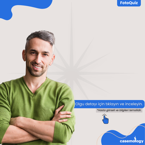 MİDE YANMASI VE AĞRI olgusu - İç Hastalıkları kategorisi