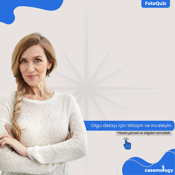 UYKUSUZLUK VE ÇARPINTI olgusu - İç Hastalıkları kategorisi