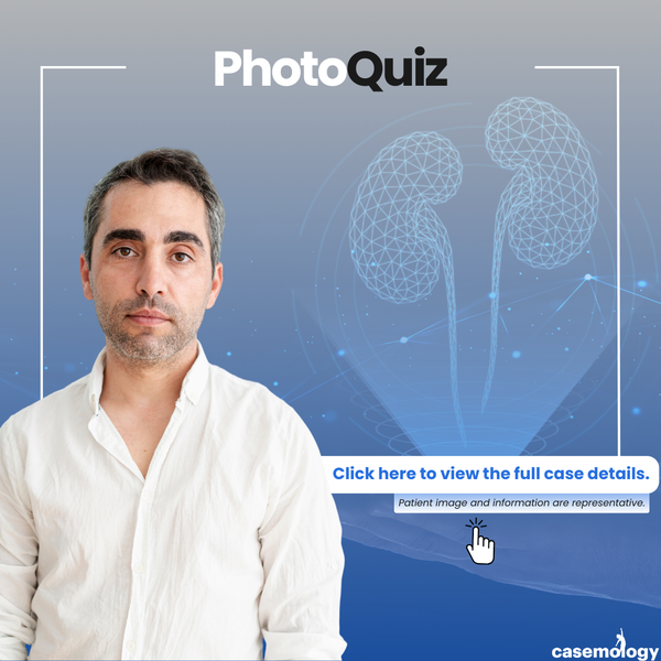 45-YEAR-OLD MALE PATIENT olgusu - Çocuk Ürolojisi kategorisi