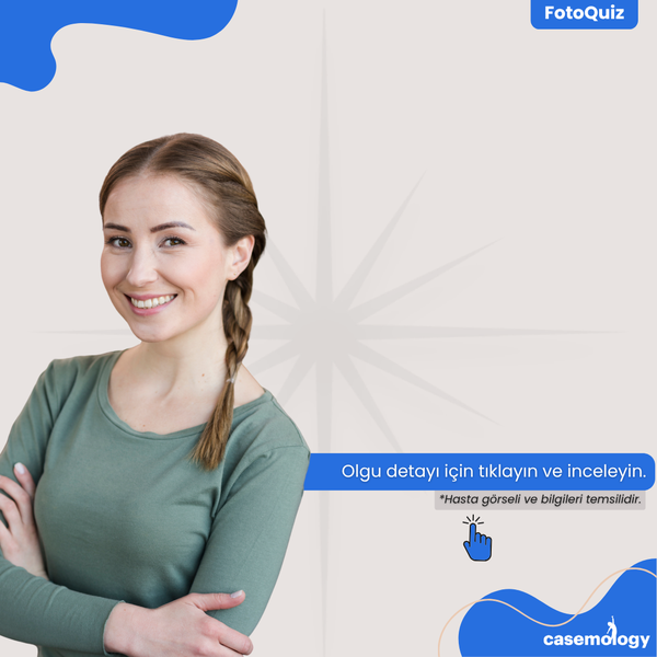 GÖZLERDE YANMA olgusu - İç Hastalıkları kategorisi