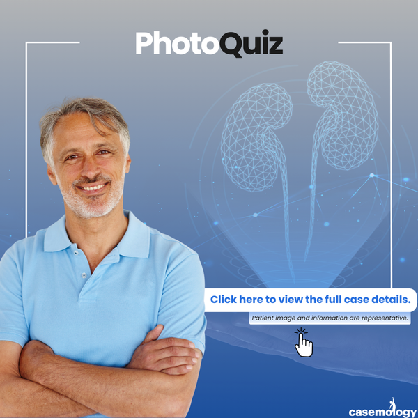 55-YEAR-OLD MALE PATIENT olgusu - Çocuk Ürolojisi kategorisi