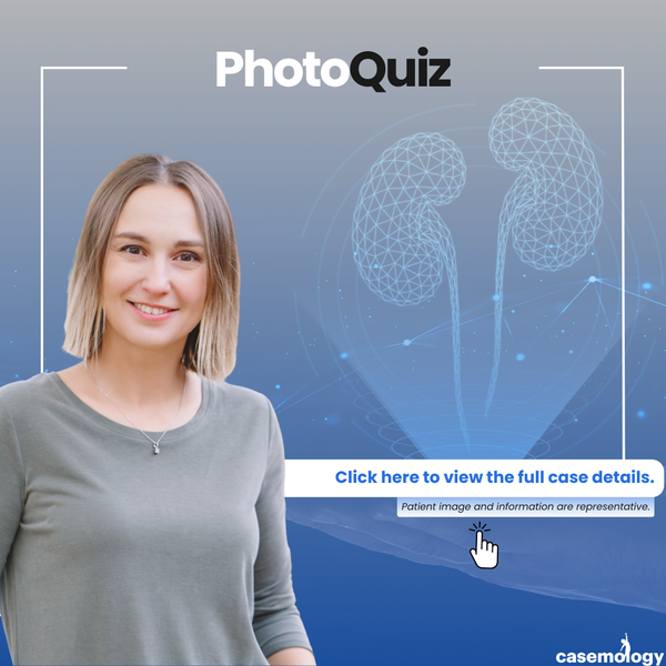 38-YEAR-OLD FEMALE PATIENT olgusu - Çocuk Ürolojisi kategorisi