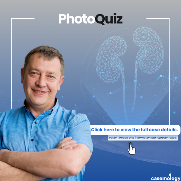 52-YEAR-OLD MALE PATIENT olgusu - Çocuk Ürolojisi kategorisi